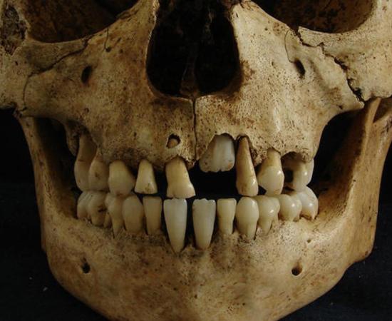 Skull of a child around the age of seven from a Roman cemetery studied by Killgrove and Montgomery. 