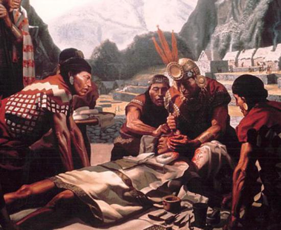 Artist’s rendition of Inca skull surgery. Credit: ThomasH