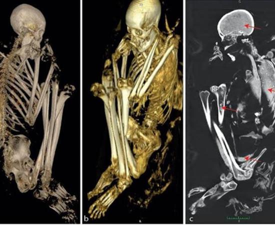 A three-dimensional volume rendering of the Tuli mummy. 