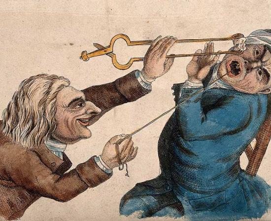 There are strange jobs, like cleaning toilets, and then there are really strange jobs, like the early barber surgeons of Europe, who drained you of blood, tore your mouth apart, and even stranger things. A sadistic tooth-drawer frightening his patient with a hot coal causing him to pull away violently in an 1810-AD color etching by J. Collier. Source: Wellcome Images / CC BY 4.0