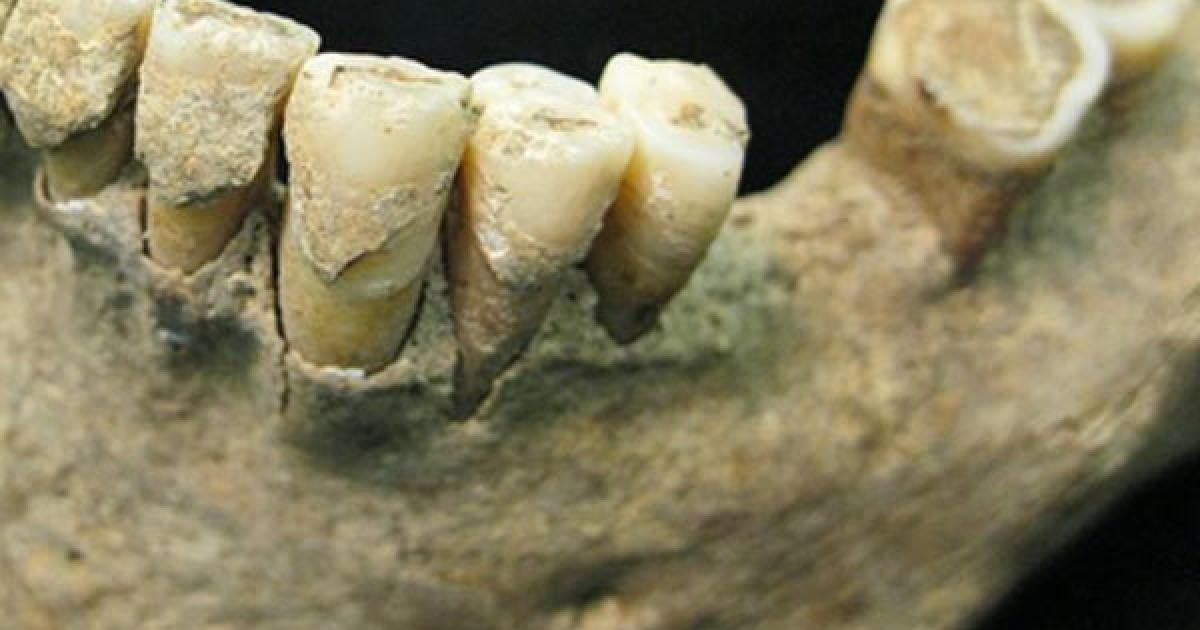 1,000-year-old tooth plaque