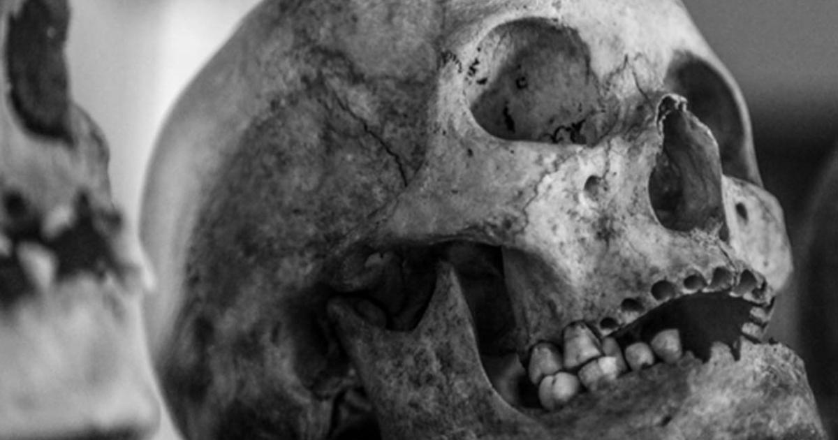 An ancient skull (public domain). Note: This image is representational only, and is not a photo of one of the skulls recently-discovered in Mayo, Ireland. Photos have not yet been released of the Neolithic Mayo bones.