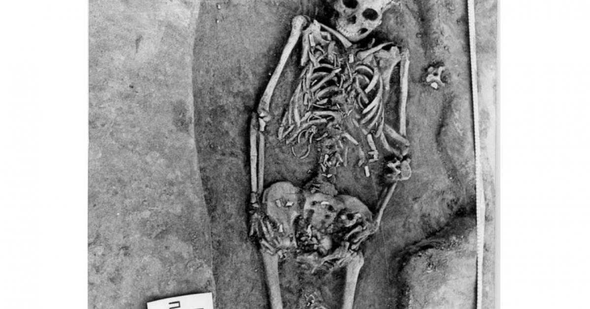Researchers said the bones of this woman's twin fetuses are visible near her pelvis and thighs