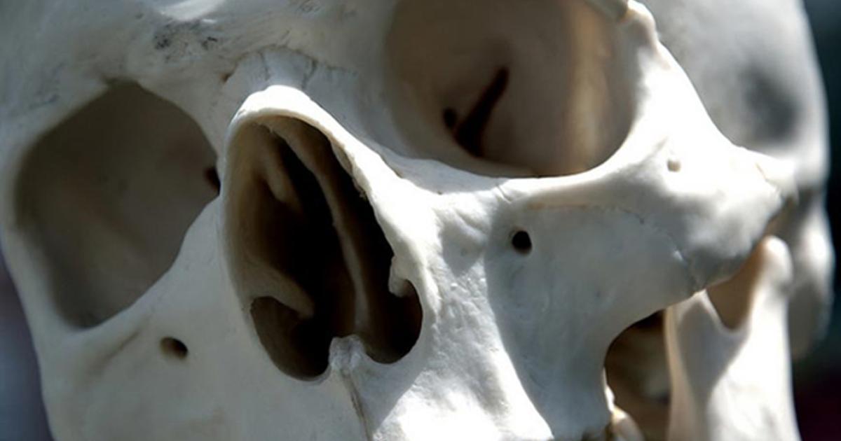 A human skull. Representational image only. 