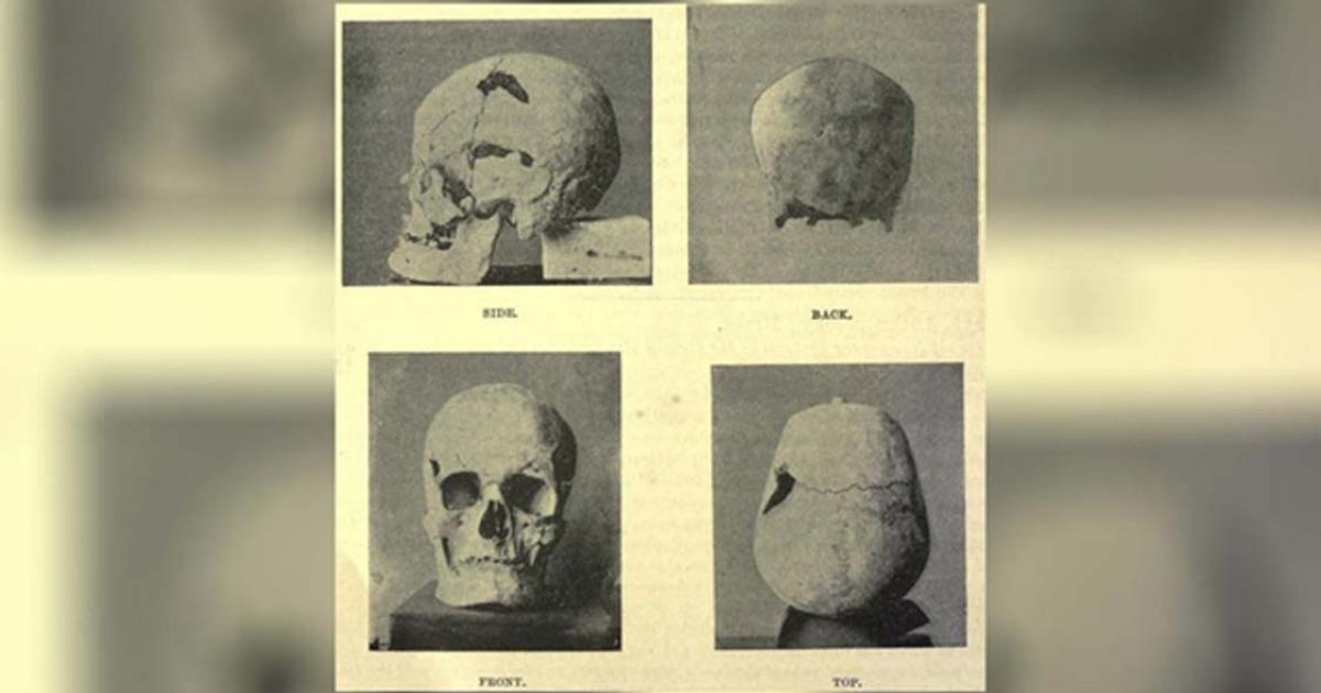 The skull of the Egyptian pharaoh Sa-Nakht, who may have had gigantism