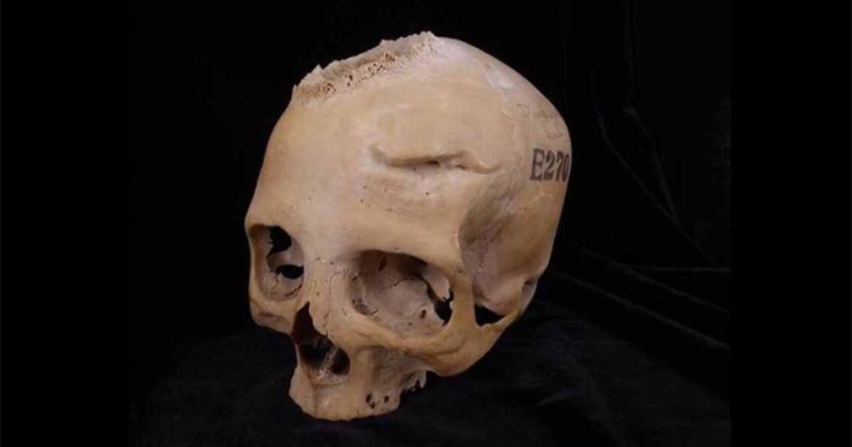 Skull E270, dating from between 663 and 343 BC, belonged to a female individual who was older than 50 years. Image: Tondini, Isidro, Camarós, 2024.                 Source: Tondini, Isidro, Camarós, 2024/Frontiers