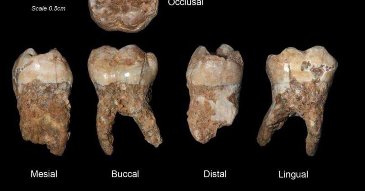 : Human teeth from Qesem Cave. Credit: Prof. Israel Hershkovitz, Tel Aviv University