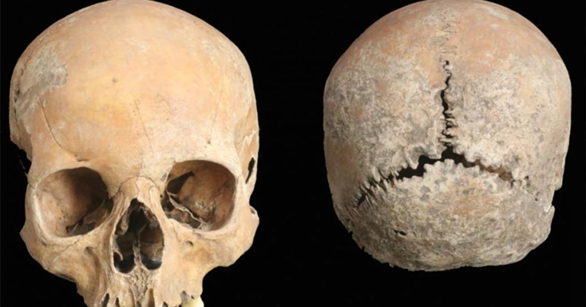 Views of the cleaned Anglo-Saxon woman’s skull.      Source: G. Cole / Antiquity Publications Ltd