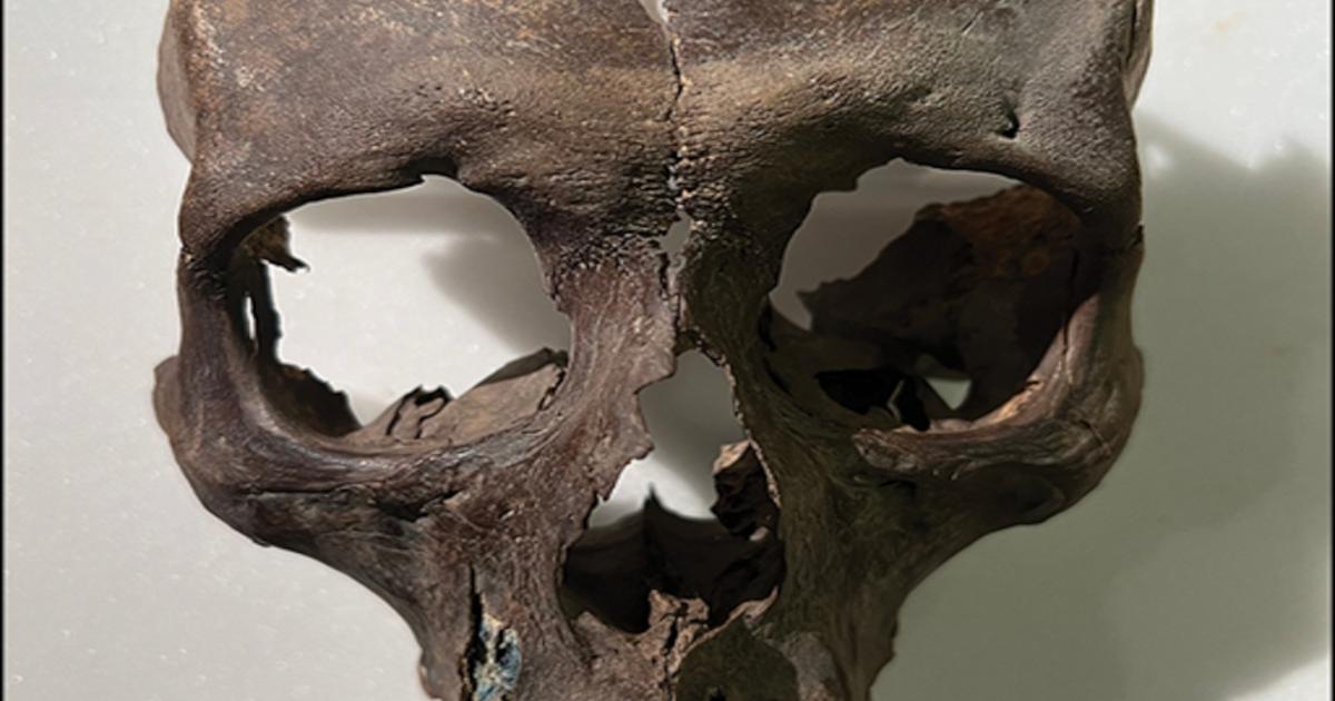 Human skull fragment recovered from the King's Stables ritual pool near Haughey's Fort, County Armagh, Northern Ireland