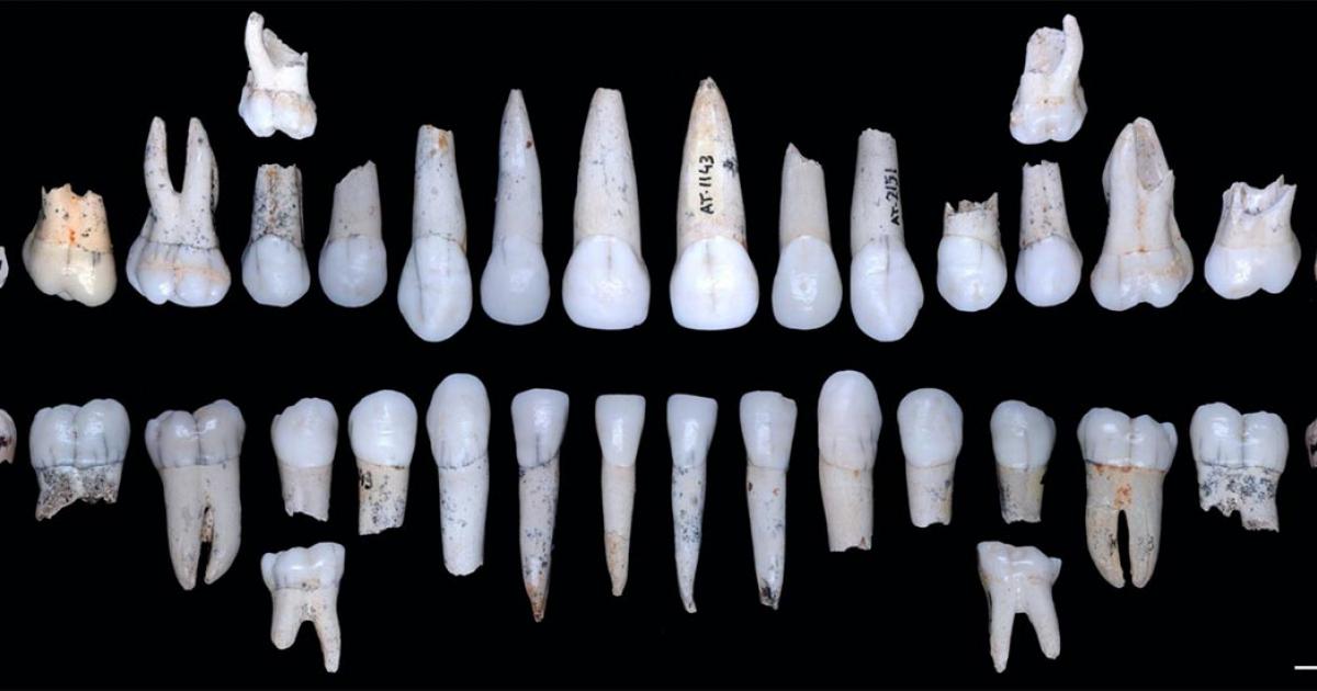 Individual XVIII teeth from la Sima de los Huesos, Atapuerca. Source: M. Modesto-Mata / CENIEH