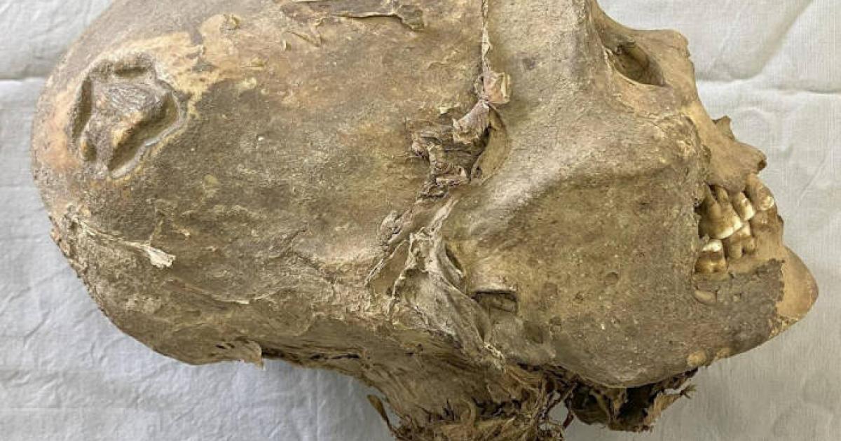 Right lateral view of the individual with cranial deformation.  