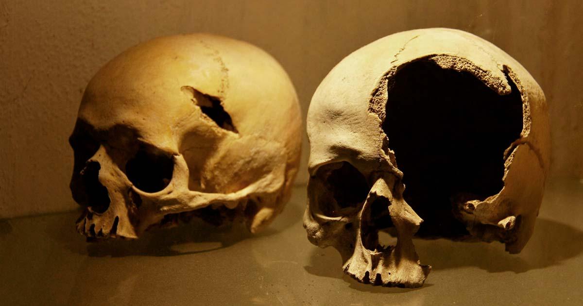 Skulls showing battle injuries. Source: Jan / Adobe Stock.