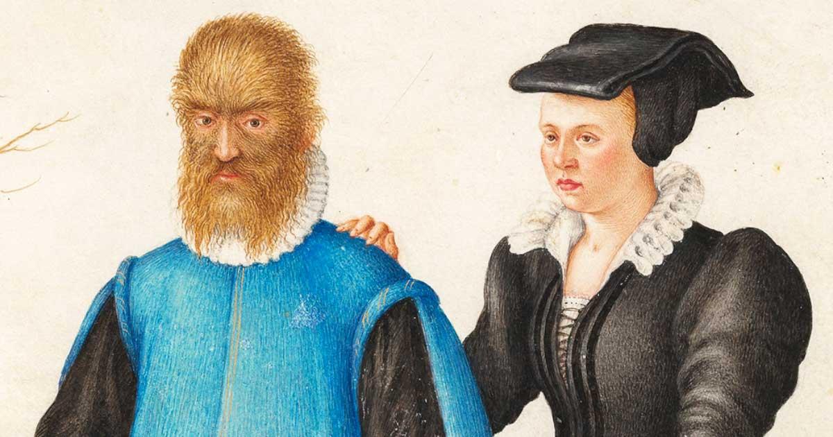 Pedro González and his wife Catherine (c. 1575) by Joris Hoefnagel. Source: Public domain