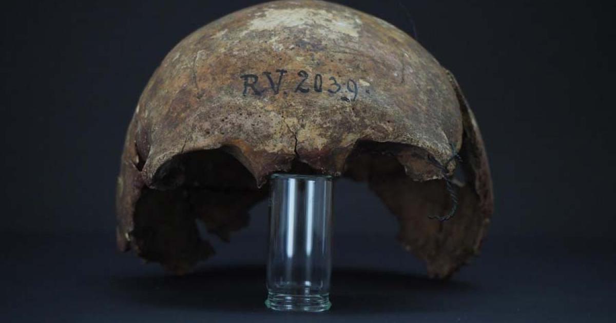 The skull of the man who died infected with an early strain of the bacterium that thousands of years later caused the devastating plague in medieval Europe. Black Death origins have now been pushed much further back in history because of this incredible scientific study.					Source: Dominik Göldner / BGAEU