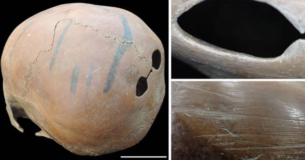 A worked human skull with two precisely drilled perforations in the parietal bones.