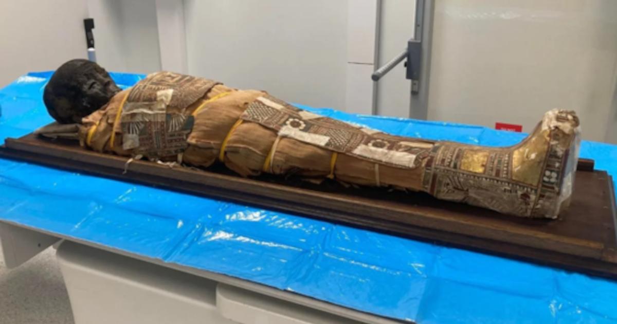 The 2,000-year-old Egyptian child mummy resting on a table before examination. 