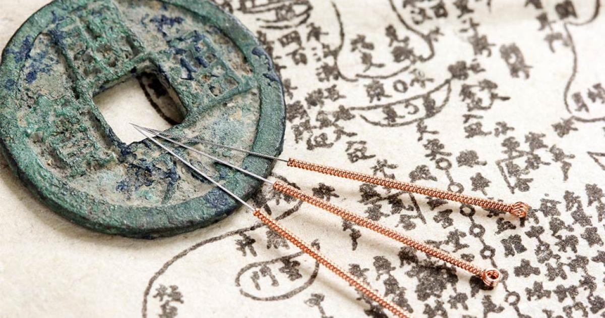 An ancient Chinese anatomy text and acupuncture needles.   Source: Yu Lan / Adobe Stock