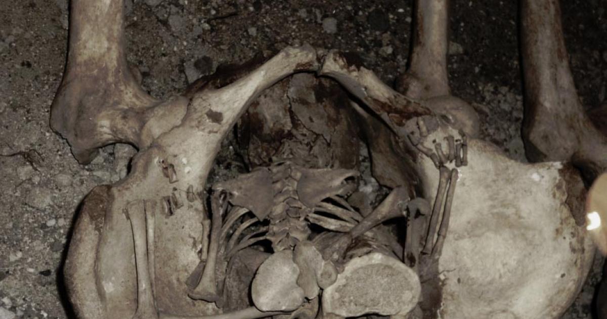 A possible example of a ‘coffin birth’.