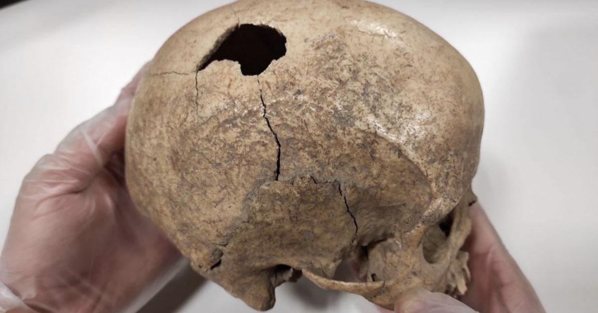 Analysis of the Cova Foradada Skull has revealed the story of the ancient incident. Source: Rovira i Virgili University (URV) 