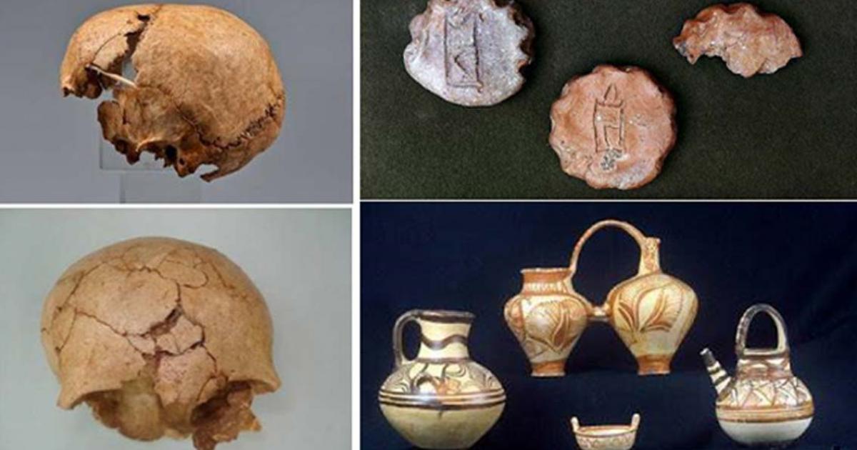 Two views of the broken skull of a young girl who was a probable victim of human sacrifice