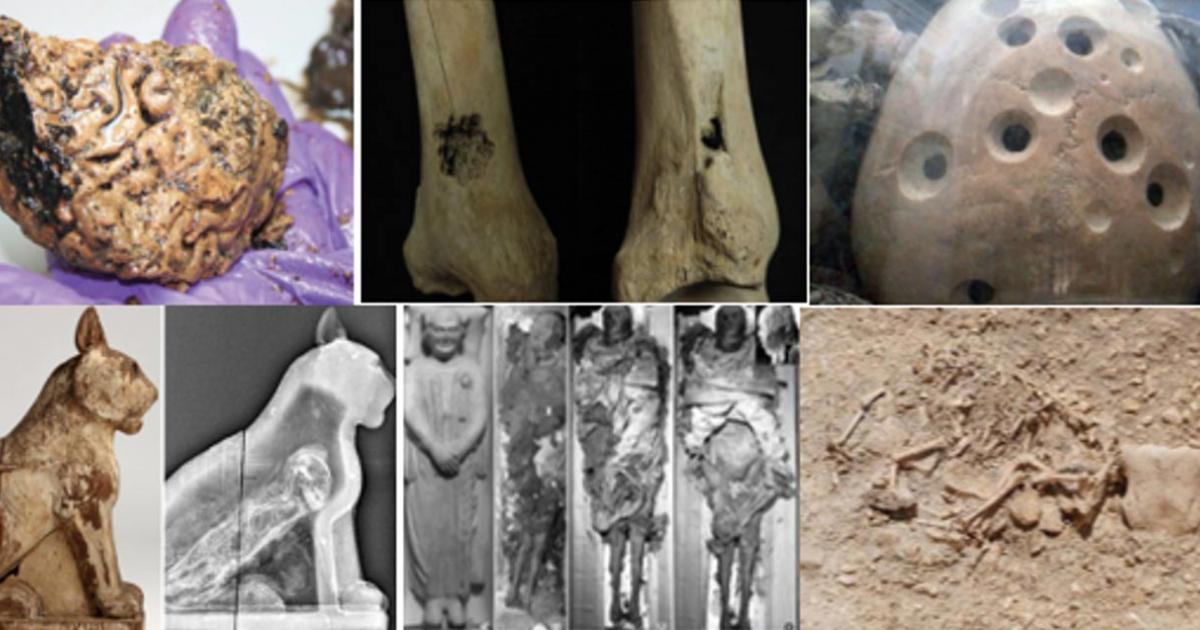 Top Ten Grisly and Gruesome Archaeological Discoveries of 2015 