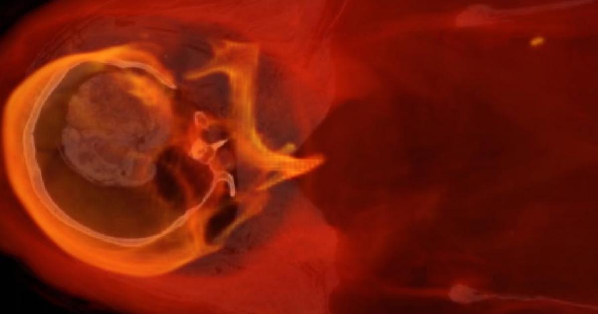 The head and upper thorax of Hatason (Fine Arts Museum of San Francisco)