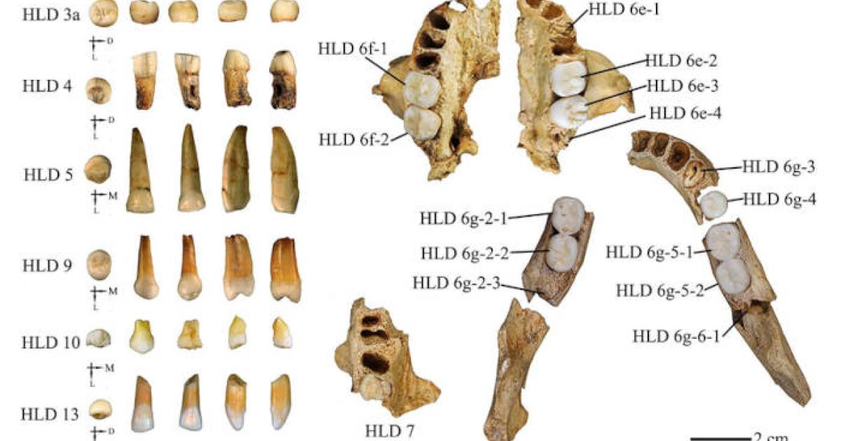 Graphic of the teeth used in the study.