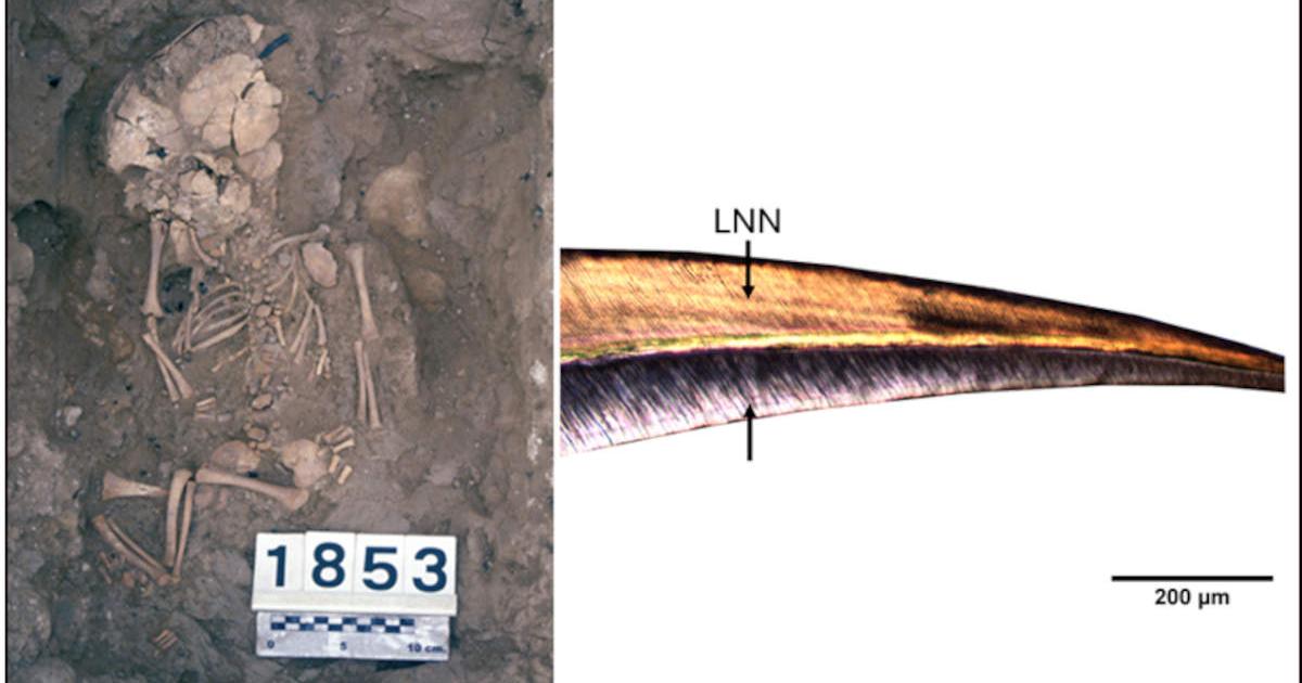Left, Burial of a perinatal individual from the Fortalesa dels Vilars, Right, baby's central incisor 