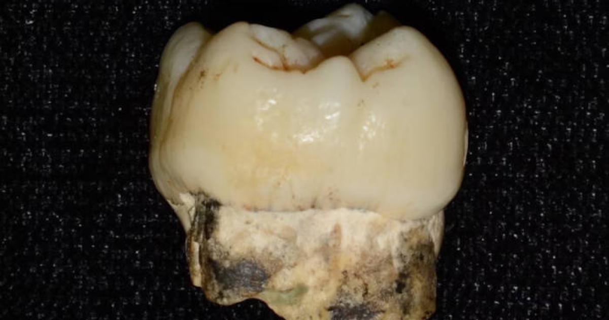 A 2 million-year-old tooth of an early human ancestor. 