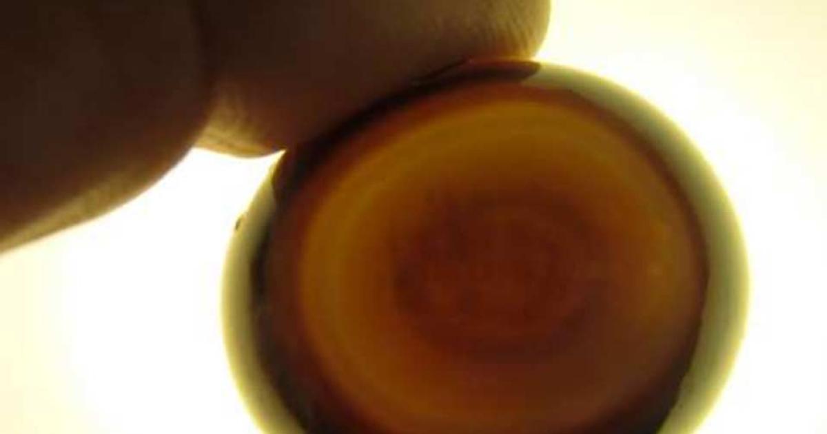 Has a Legendary Gem from a Sacred Jewish Breastplate Been Rediscovered?