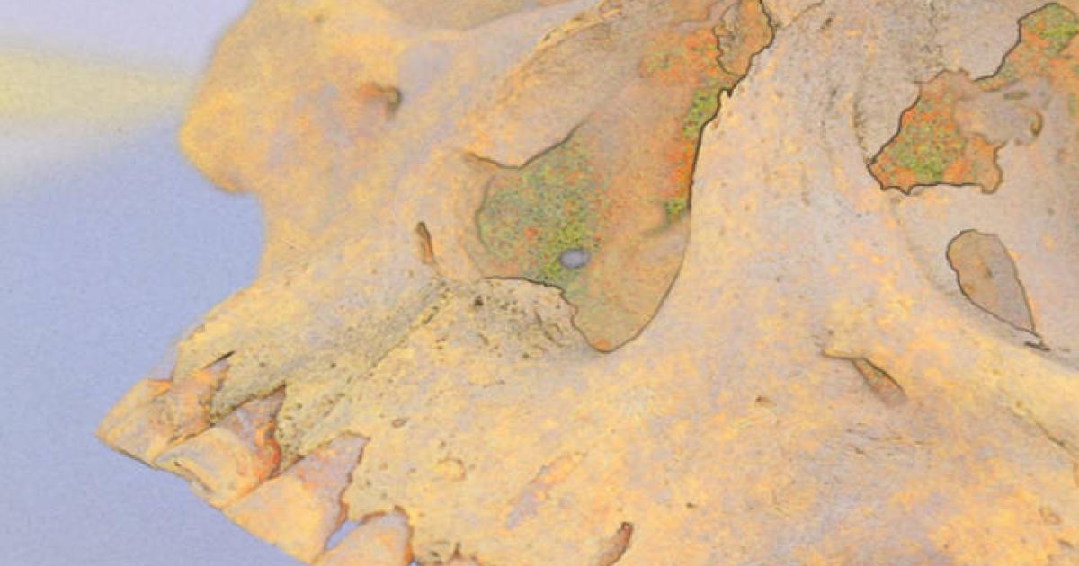 Special imaging of 4,000-year-old skull from which two genomes of Mycobacterium lepromatosis  were sourced.