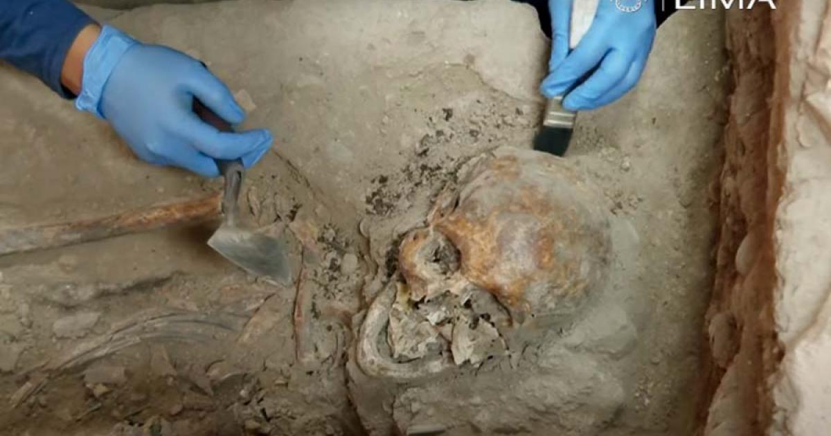 A skull of one of the Spanish syphilis patients who died in Lima’s fist hospital that was built just 20 years after Pizarro took over the Inca Empire.		Source: Municipalidad de Lima