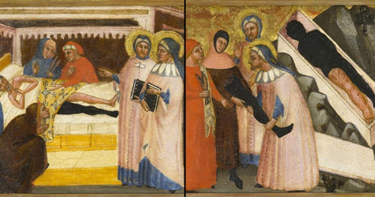 The painting of Saints Cosmas and Damian that shows the reported miraculous healing of a man by amputating his leg and transplanting the healthy leg of a dead man onto his body, then placing the diseased leg in the casket of the deceased. 