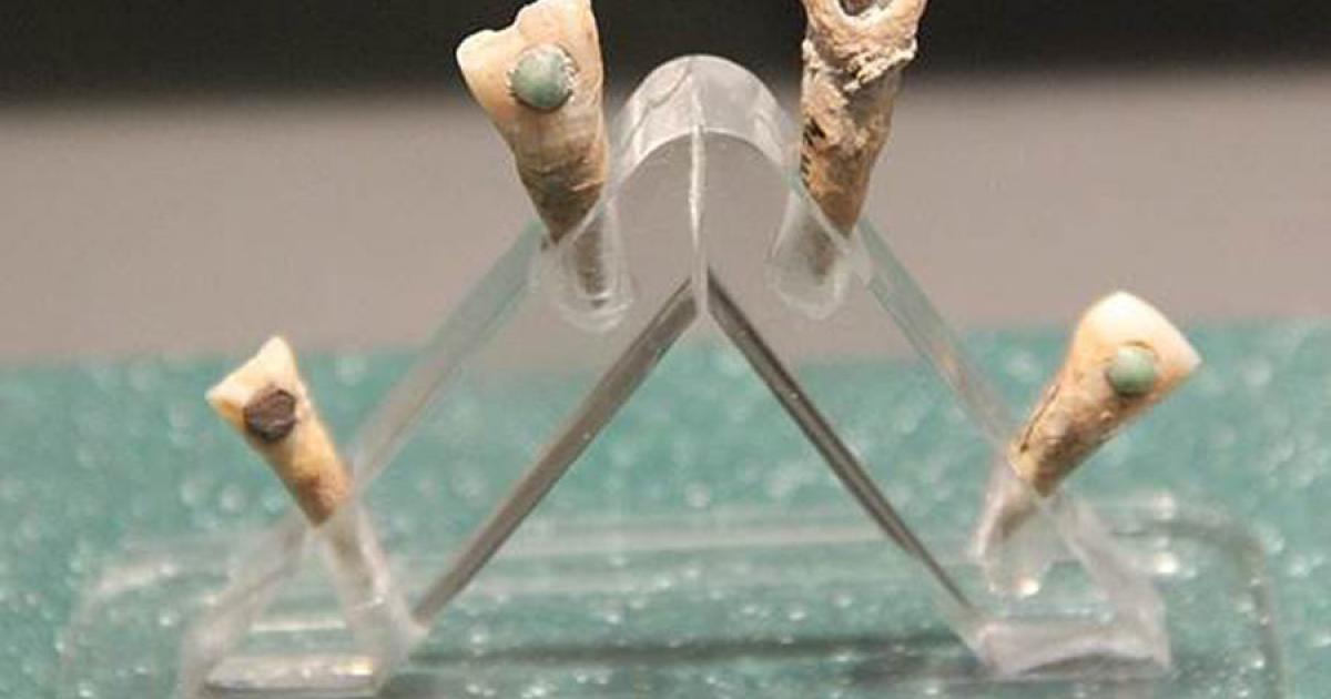 Maya teeth were turned into jeweled teeth by skilled ancient dentists, but a recent study suggests that this also benefited oral hygiene!		Source: Gary Todd / CC0