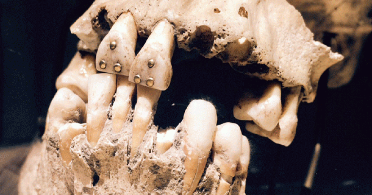 Ancient Dentistry - golden teeth