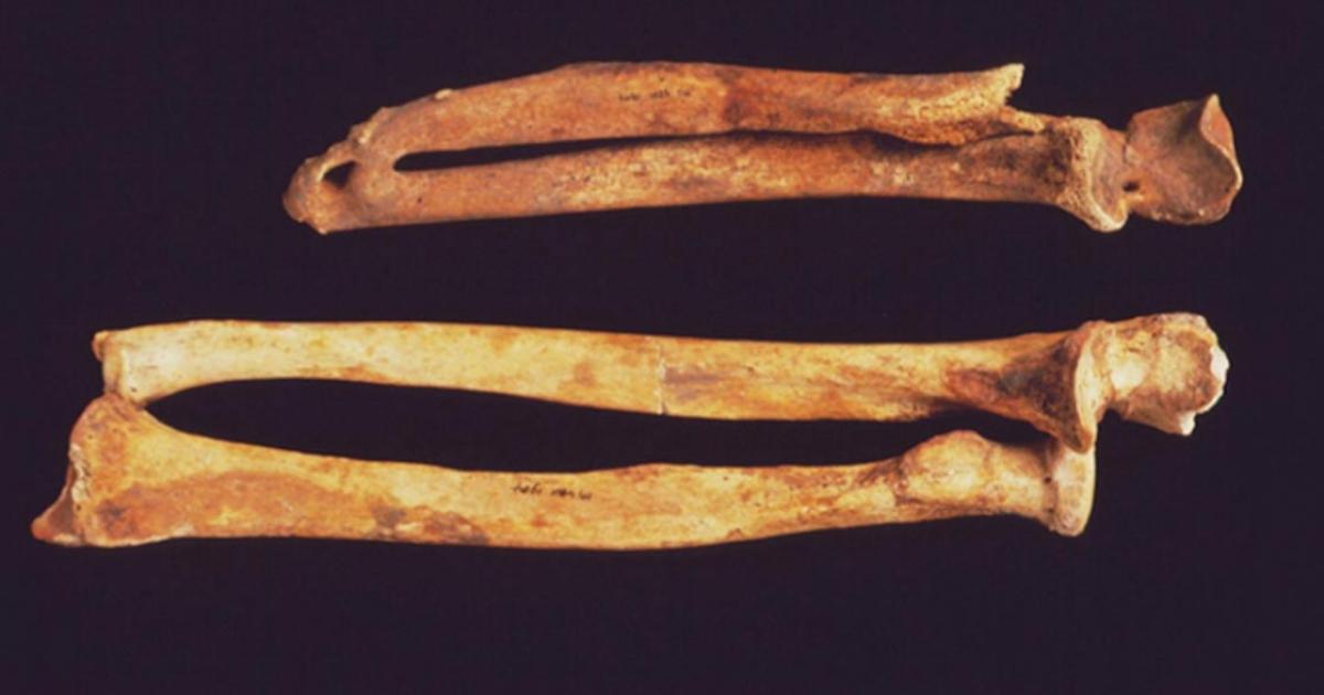 An arm from a body in the cemetery of Ipswich friary