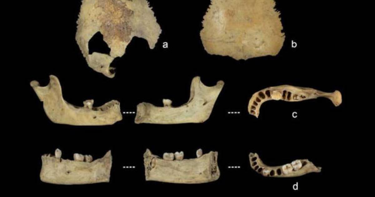 Human bone specimens used to estimate age at death, showing evidence of processing and damage consistent with systematic cannibalism