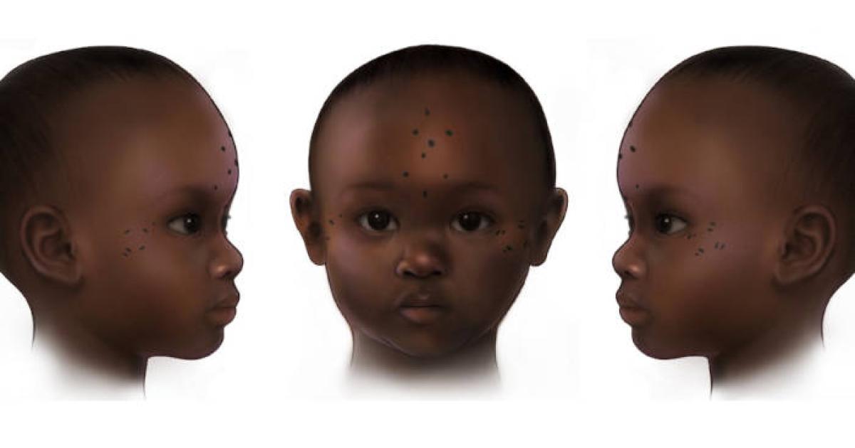 Reconstruction of tattooing on the forehead of a 3-year-old female (657–855 AD) from ancient Nubia.