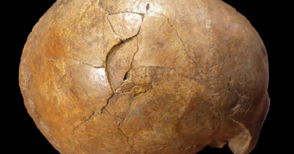 Right lateral view of the Cioclovina calvaria exhibiting a large depressed fracture.      Source: Kranoti et al / Plos One