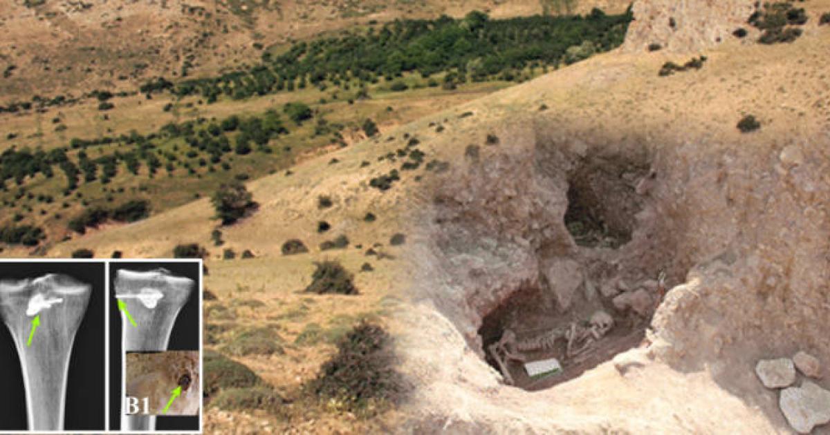 Archaeological excavation work at Liyarsangbon Cemetery site. Inset, Image of the tibia bone with an embedded arrowhead. 