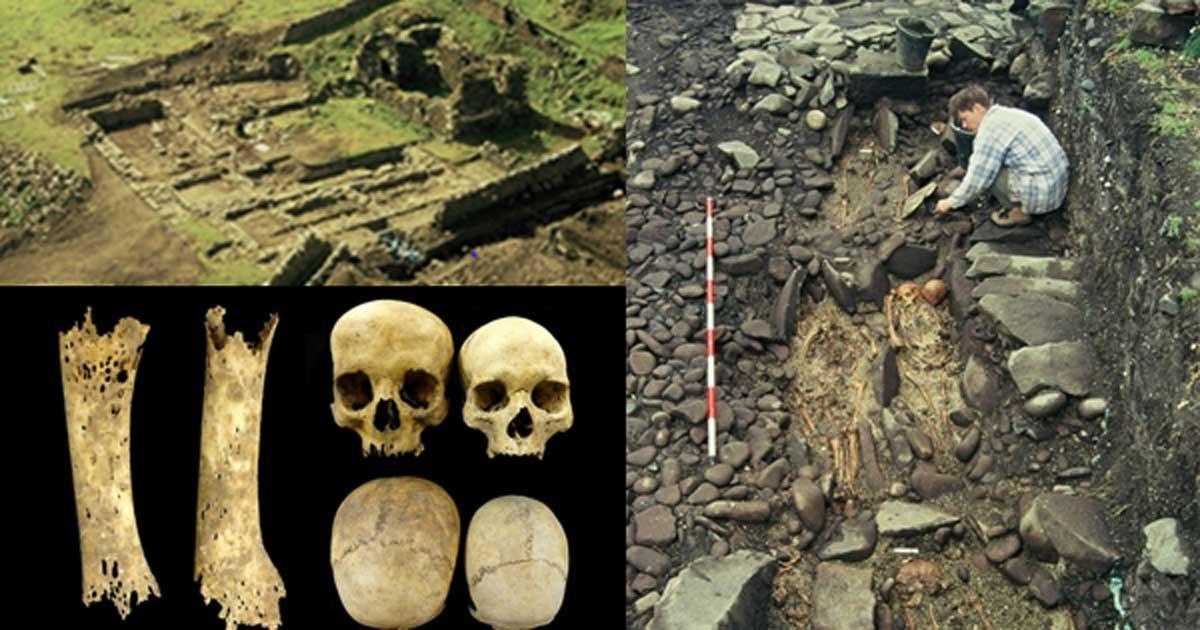 Isle of May monastery ruins (Peter Yeoman) top left; Skeletal remains on May (Peter Yeoman/ British Archaeology Magazine); The foot bones of a teenager with syphilis (left). An enlarged skull, possibly due to hydrocephaly (right). (Images: Marlo Willows/British Archaeology) bottom left.