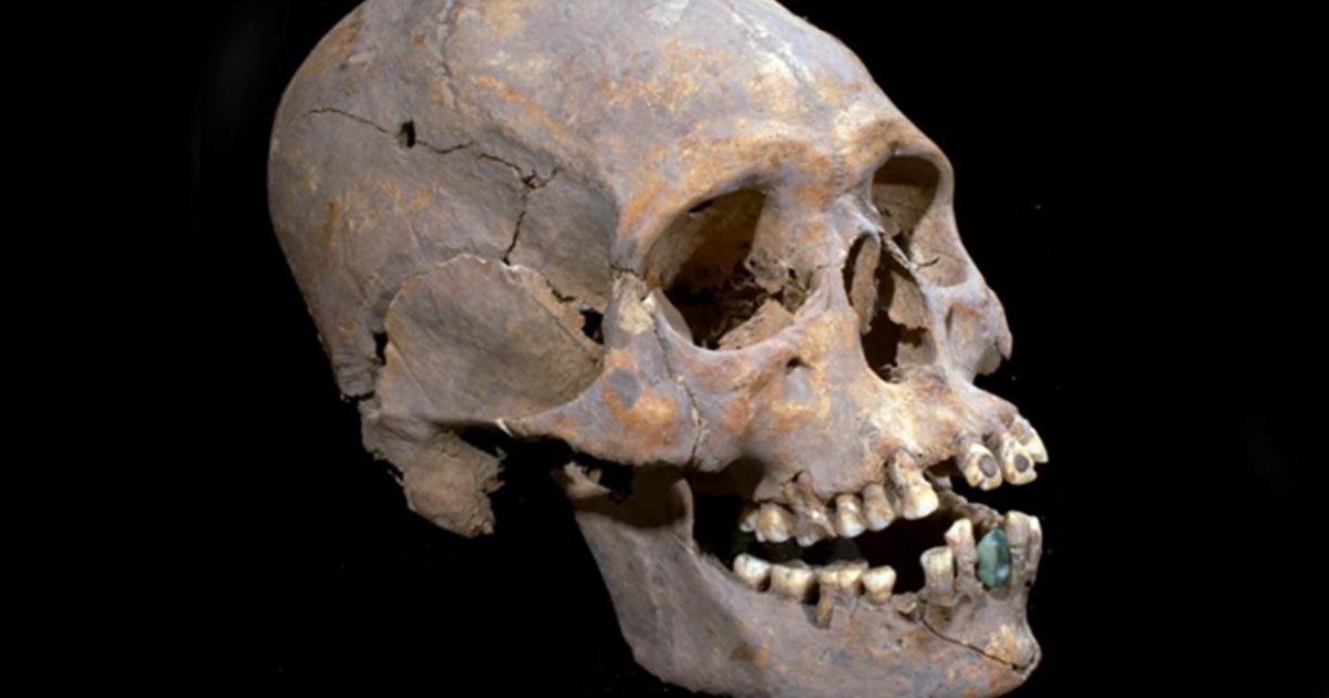 The elongated skull with stone encrusted teeth found in Teotihuacan, Mexico. 