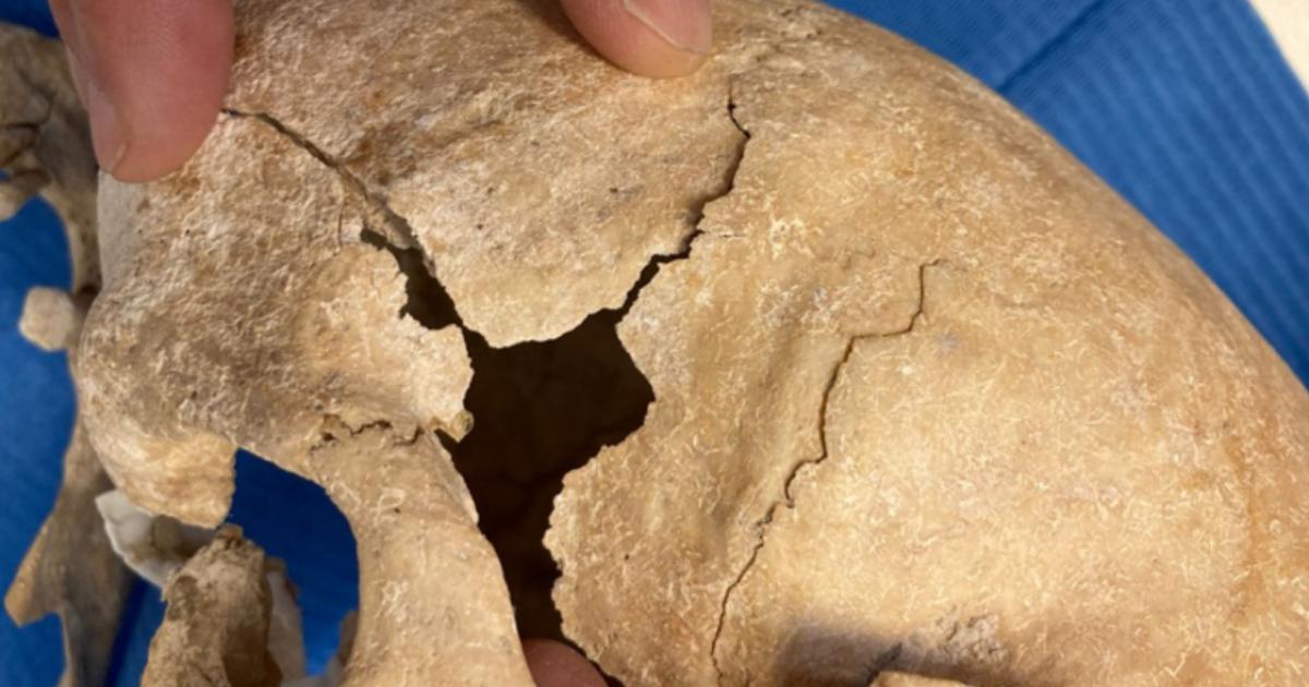 Damaged cranium of one of the warrior monks