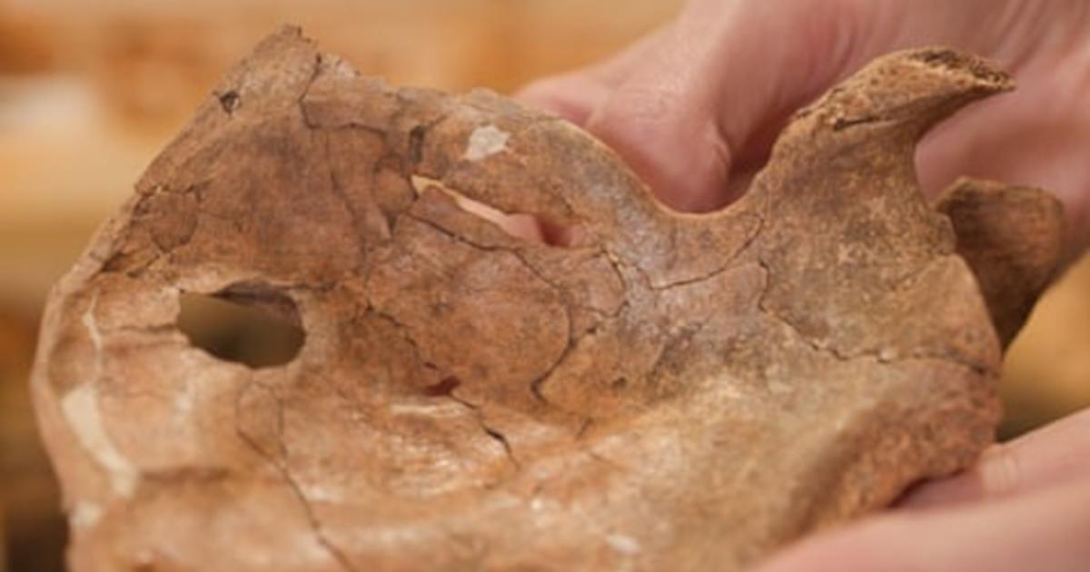Left scapula of Neanderthal from Shanidar Cave, with hole visible