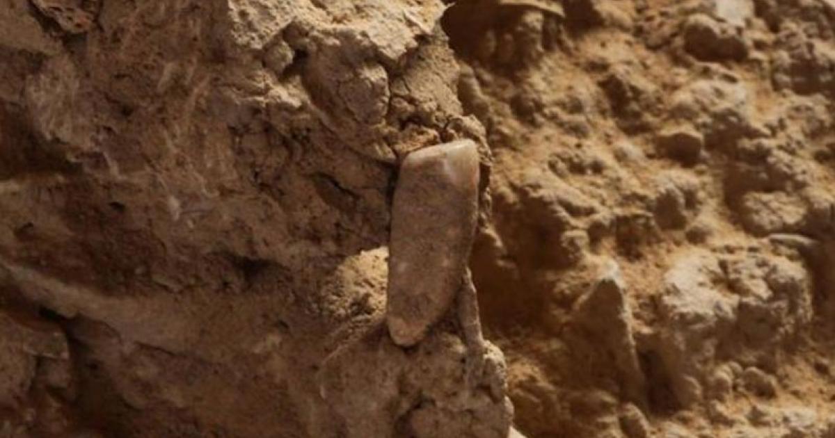 The tooth before it was removed. Credit: Musee Homme de Tautavel