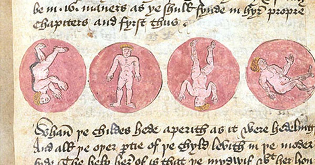 Medieval medical text 