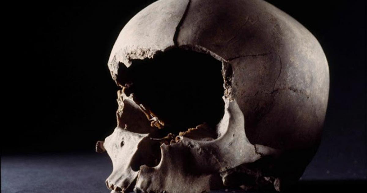 The skull of a man, 25-40 years, with his face cut off with a sharp weapon. The head was found in a well outside a pit house from the 9th century in Aarhus, Denmark. Source: Rogvi N. Johansen/Moesgaard Museum