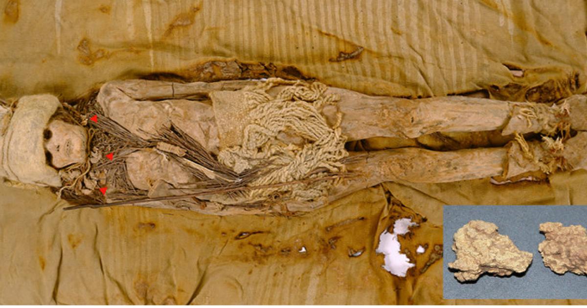A photo of one of the mummies from the Xiaohe cemetery, with the kefir samples (highlighted with red triangles) scattered around the neck of the mummy