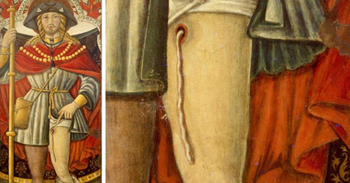 A painting of 14th century St. Roch shows the dracunculiasis worm exiting the upper part of his leg.