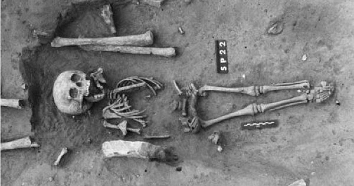 Ancient burial of a child with Down syndrome